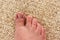 Close up damaged toenail on carpet