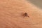 close-up deer tick trying to bite through human skin. Danger Infection through the bite of a dangerous insect that causes Borrelia