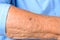 Close up detail of the forearm of an elderly woman