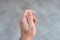 Close up detail of a left hand showing a thumb with a white and bitten nail condition