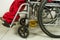 Close up disabled person in a wheelchair in a hospital or clinic to which the urine catheter drainage bag is attached which is fil