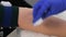 Close-up of the doctor`s hands disinfect the injection site with a cotton swab on the patient`s arm in the clinic