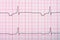 Close-up of ecg graph