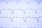 Close-up of an EKG tracing of a patient with a cardiac pacemaker. Pacemaker beats