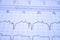 Close-up of an EKG tracing of a patient with a cardiac pacemaker. Pacemaker beats recorded on paper