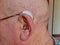 Close up of an elder`s ear with a hearing aid on, a device designed to improve hearing by making or amplifying sound audible to a