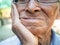 Close up of Elderly man biting on cotton gauze after tooth extraction, Tooth decay from not like brushing teeth. Oral care