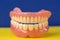 Close-up of false teeth. Removable dentures. Diagnosis of gum disease. Dental clinic concept.