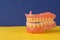 close-up of false teeth removable dentures, the topic of dental prosthetics, loss of teeth. care for