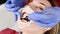 A close-up of the girl`s face is examined by a dental examiner with his mouth open and a napkin and eyes closed. Dentist