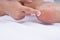 Close-up hand of patient putting on moisturizer lotion or medicine cream to treat broken skin on foot on white background. Medical