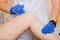 Close-up of hands in gloves remove hair on client`s leg with hot sugar. Epilation process