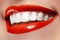 Close-up happy female smile with healthy white teeth, bright red lips make-up. Cosmetology, dentistry and beauty care