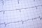 Close-up of heartbeats recorded on the paper of the electrocardiogram. Selective focus. Approach to a cardiac arrhythmia