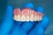 Close-up human denture of the upper jaw on a blue background in the hand of a dentist wearing a medical glove