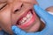 Close-up inside the oral cavity of a healthy child with beautiful rows of baby teeth. Young girl opens mouth revealing upper and