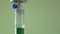 Close-up of intravenous infusion line, hospital patient, iv drip