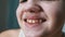 Close-up of Lips and Mouth of a Child with a Beautiful Wide Smile with Teeth