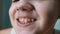 Close-up of Lips and Mouth of a Child with a Beautiful Wide Smile with Teeth