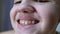 Close-up of Lips and Mouth of a Child with a Beautiful Wide Smile with Teeth