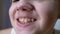 Close-up of Lips and Mouth of a Child with a Beautiful Wide Smile with Teeth