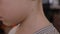 Close-up of a little boy`s neck with a blister from chicken pox on his neck.