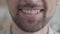 Close-up of the lower jaw of an adult sad bearded man trying to smile with a forced smile. Negative mood, problems