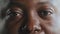 Close up male eyes body part face in detail african american adult sick sad man guy with dark skin client of