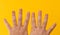 Close up Male fingers with bitten, gwaned, chewed or ugly nails, a Bit bad nail and isolated on a yellow background