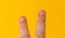 Close up Male two fingers with bitten, gwaned, chewed or ugly nails, a Bit bad nail and isolated on a yellow background