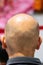 Close-up of man with shaved scalp suffer balding alopecia