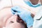 Close-up Mechanical face peel at the beautician. Beautician squeezes acne on the patient`s forehead with a medical