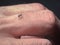 Close-up Mosquito bites that eat blood o the fingers of men cause disease spread.