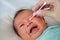 Close up mother use cotton bud to clean baby eyes