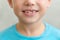 Close-up mouth of little boy with growing teeth and smile