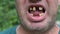 Close-up of the mouth of a toothless man. He moves his lips and shows a toothless mouth cavity. Disgusting. 4k video format.