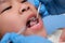 Close-up in the oral cavity of a healthy child with beautiful white teeth. Young girl opens her mouth to reveal healthy teeth,