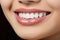 Close-Up of Orthodontic Dental Treatment. Perfect Smile with Bright White Teeth and Expert Care