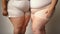 Close up of an overweight two women in tight clothes., plus size female waistline, belly, body positivity