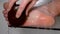 Close up - peeling and cracked foot in a person. Fungal infection or mycosis, sweaty feet. scrub to wash the foot of a man`s leg