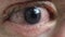 A close up of a person\\\'s eye with redness and a blue pupil