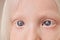 Close-up photo of albino child eyes