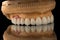 Close-up photo of a dental upper jaw prosthesis on black glass background. Artificial jaw with veneers and crowns. Tooth