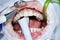 Close-up picture of a woman's mouth during dental procedure of cleaning teeth