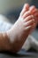 A close up portrait of the bare feet of a baby. The little toes and nails are visible. The skin on the foot in focus is peeling a