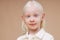 Close-up portrait of little albino girl