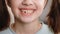 Close up portrait of young caucasian little girl smiling with a toothless smile. Loss of milk teeth, replacement of
