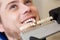 Close up portrait of Young man in dentist chair, Check and select the color of the teeth. Dentist makes the process of treatment i