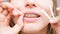 Close-up portrait of a young woman applying orthodontic anti-scratch wax to the braces