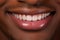 Close-Up of a Radiant Black Mans Perfect Smile - Captivating with White Teeth, Exuding Luxury